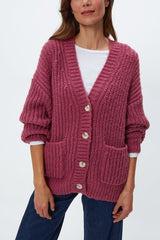 Michael Stars Skye Grandpa Cardi in Baby Plum - Viva Diva Boutique